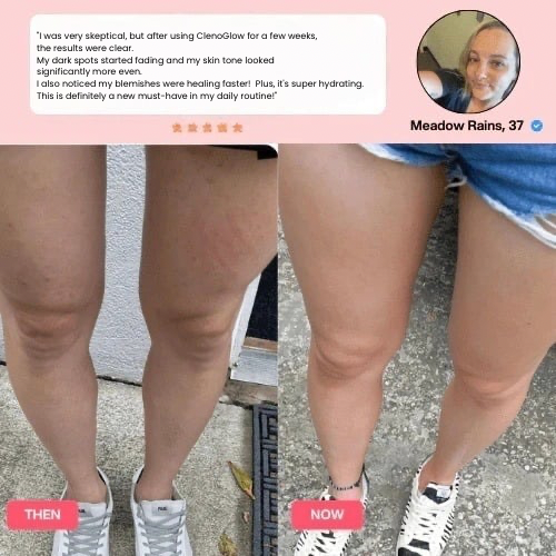 ClenoGlow Fit Cellulite Massager